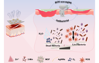 Ultrathin transparent metal-organic framework-based nanocomposite membranes for antibacterial wound healing 2025.100749